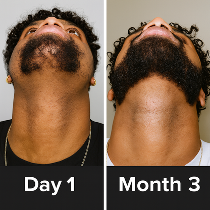 Beard Serum Roll-On